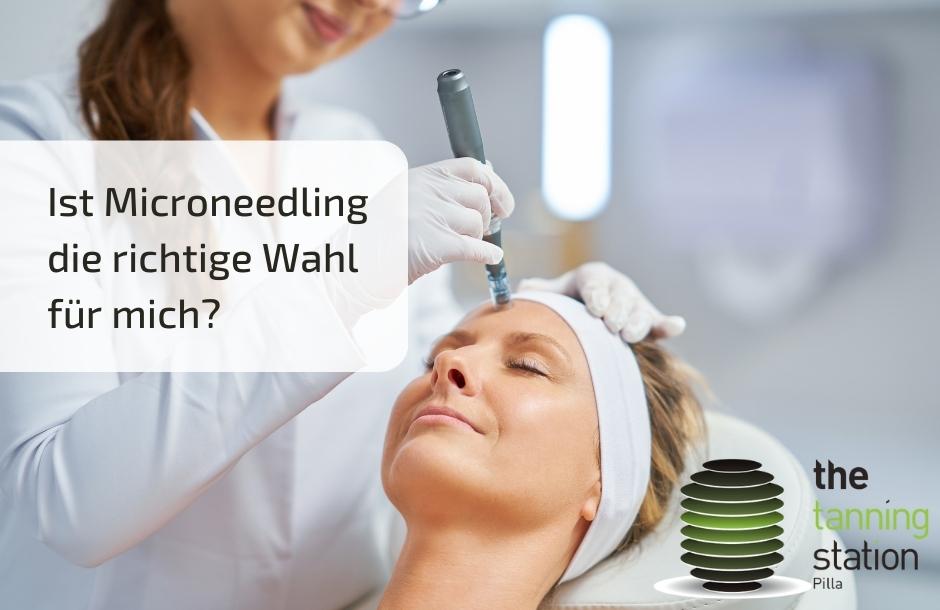 Ist Microneedling die richtige Wahl für mich?