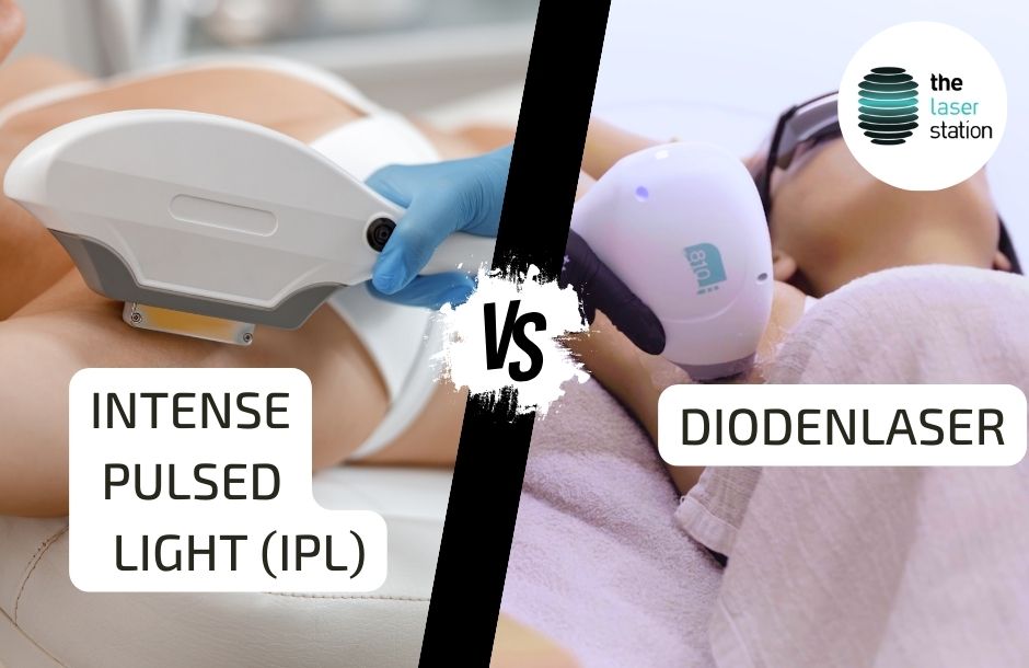 IPL vs Diodenlaser Titelbild des Blog-Beitrags