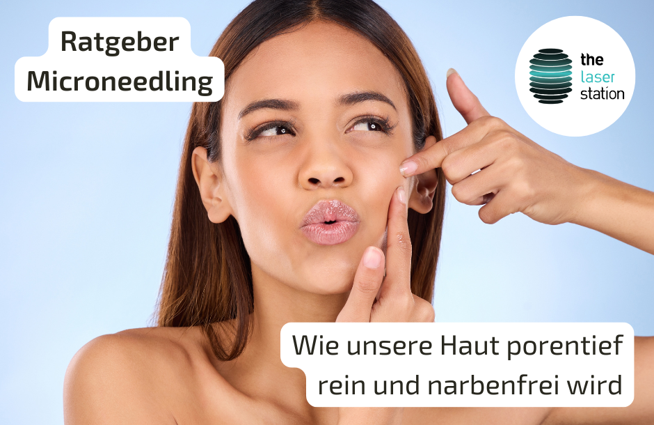 Ratgeber Microneedling gegen Narben Blog-Post Grafik mit junger Frau mit reiner Haut